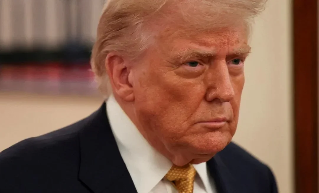 Moretones y piernas hinchadas: anunciaron que Trump sufre una insuficiencia venosa crónica, común en mayores de 70