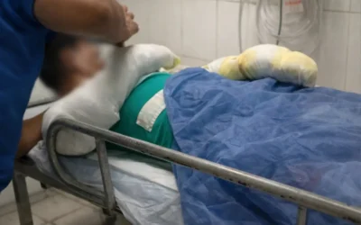Córdoba: un adolescente fue internado con el 60% del cuerpo quemado tras explotarle el celular