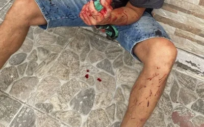 La Rioja: Violento ataque con machete en pleno macrocentro deja un joven herido