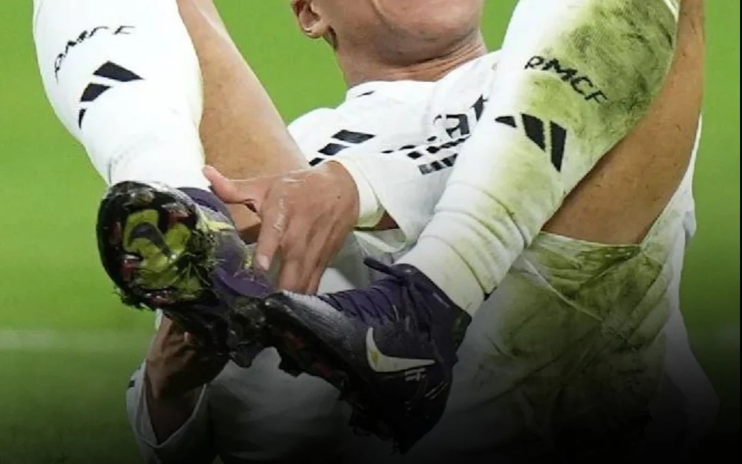 Se confirmó la lesión de Kylian Mbappé a 45 días del comienzo del Mundial