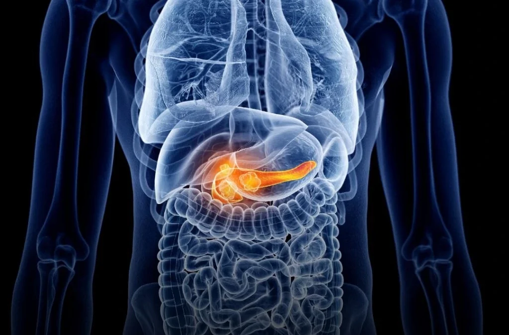 Un nuevo medicamento para el cáncer de páncreas fue aprobado por la FDA